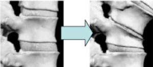 3-vertebra-normale