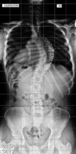 5-radiografia