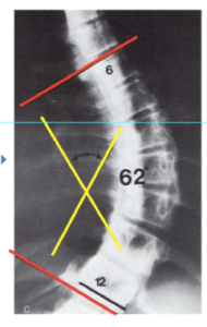5-t6-t12