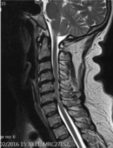 8-RM-CERVICALE